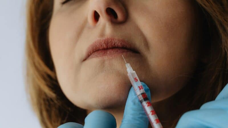 What Makes Lip Injections One of the Most Requested Treatments Today