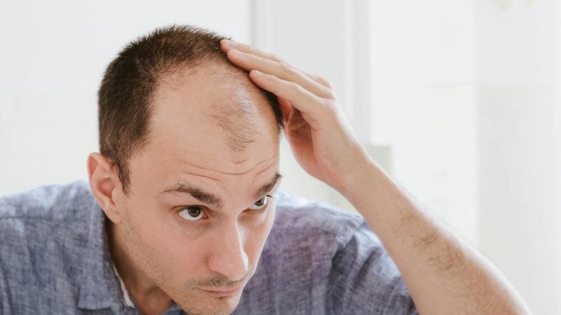 What I Wish Someone Told Me Before I Chose a Hair Transplant