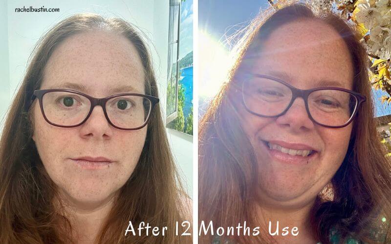 After 12 months