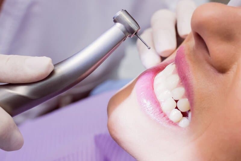 Dental Crowns in Mississauga, ON