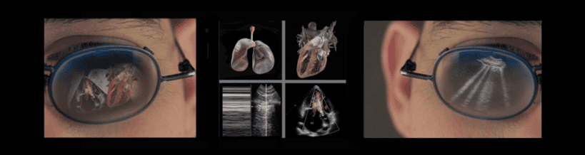 Hands-on COVID Lung & POC-Echo ultrasound training course.