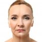 Mature woman face before and after cosmetic procedure. Plastic surgery concept.