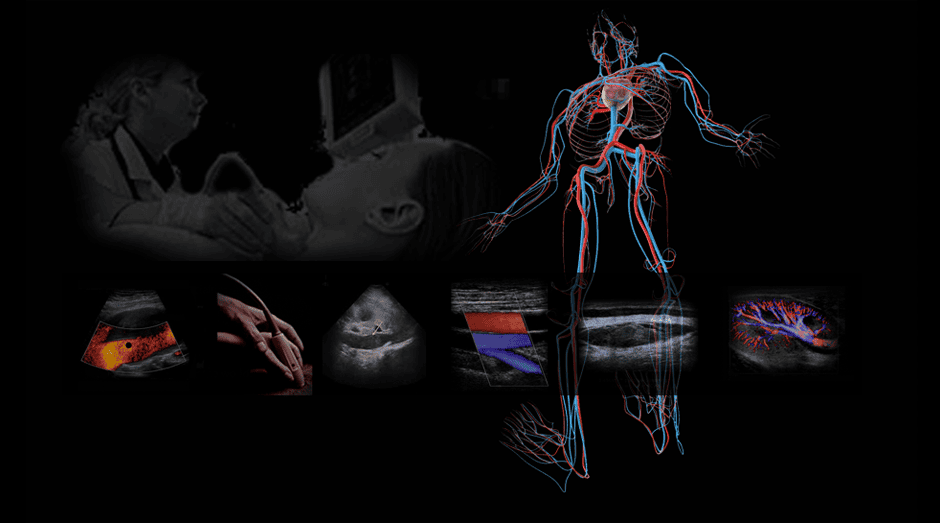 Comprehensive hands-on ultrasound protocols and techniques to master ultrasound scanning for arterial and venous ultrasound.