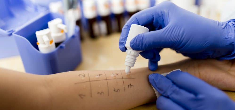 prick test