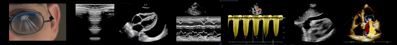 Hands-on COVID Lung & POC-Echo ultrasound training course.