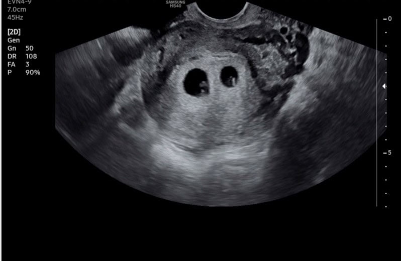Pregnancy-related eye scan — Makari Wellness