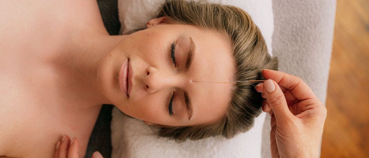 Difference between dry needling and acupuncture — acupuncture treatment at Makari Wellness
