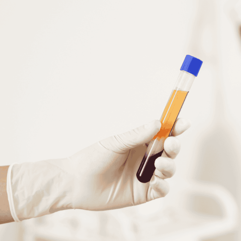 자가혈뼈이식임플란트