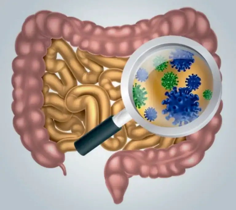 SIBO: o que é, sintomas, tratamento e dieta (supercrescimento bacteriano)