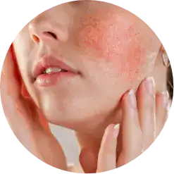 InMode EvolveX Transform